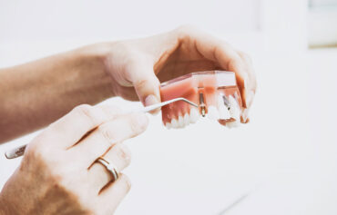 Dental Extraction