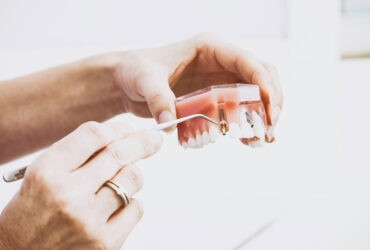 Dental Extraction